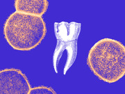 Editorial illustration showing a white engraved tooth surrounded by orange and blue stylized bacterial or viral cells on a purple background.