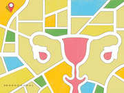 Editorial illustration showing a stylized uterus and ovaries overlaid on a colorful street map with a location pin marker.