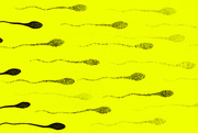 Editorial illustration showing sperm cells on a bright yellow background, used decoratively for an article about fertility or reproductive health.
