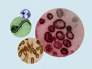 Editorial collage of four colorized microscope images of viruses arranged as overlapping circles on a light blue background.