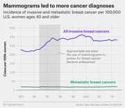 Line chart showing incidence of invasive and metastatic breast cancer per 100,000 U.S. women ages 40 and older from 1975 to 2010, with a shaded region marking the era when mammogram screening became widespread.